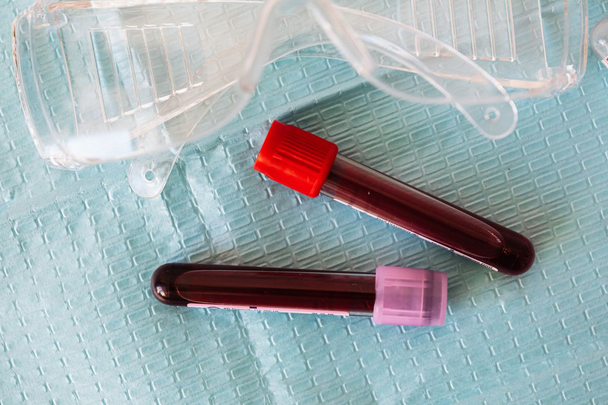 What Pre-Operative Testing Is Required at Harmon Facial Plastic Surgery?